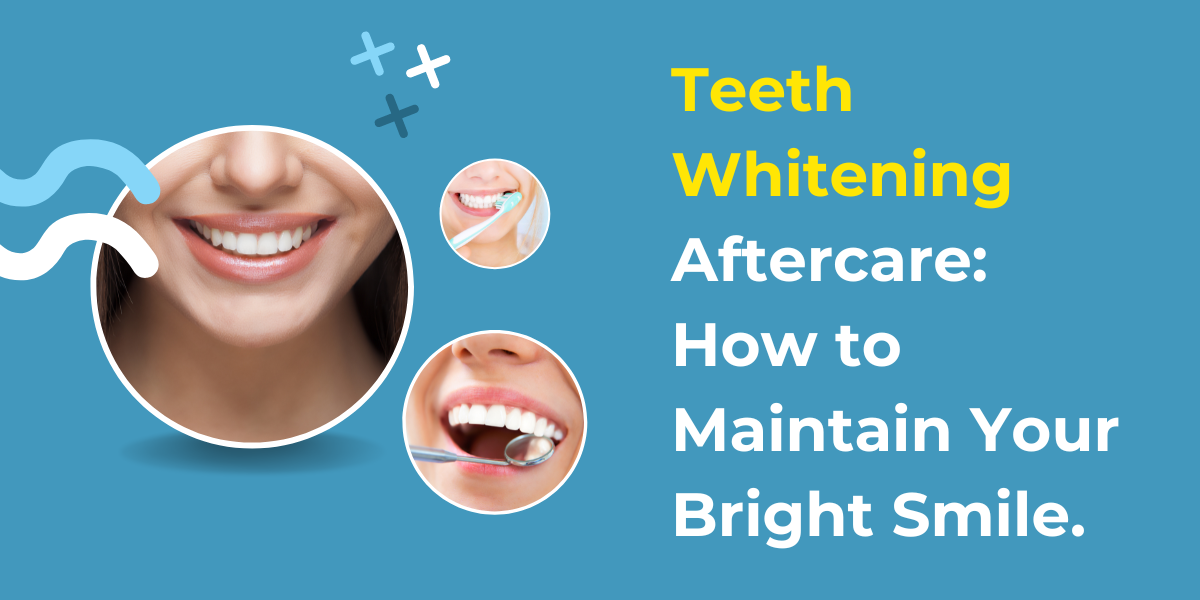 Teeth Whitening Aftercare: How to Maintain Your Bright Smile.