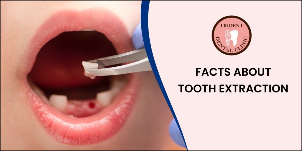 Tooth removal