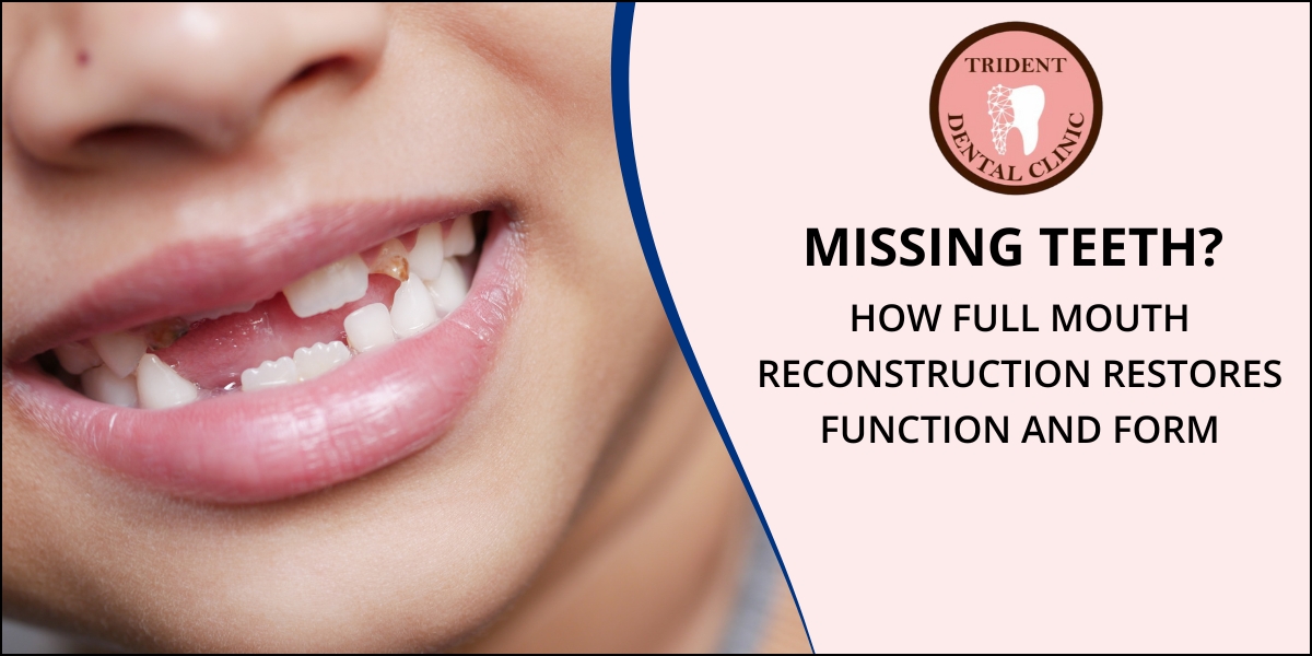 Missing Teeth Treatment